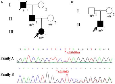 Phenotypic and Genotypic Characterization of NPRL2-Related Epilepsy: Two Case Reports and Literature Review